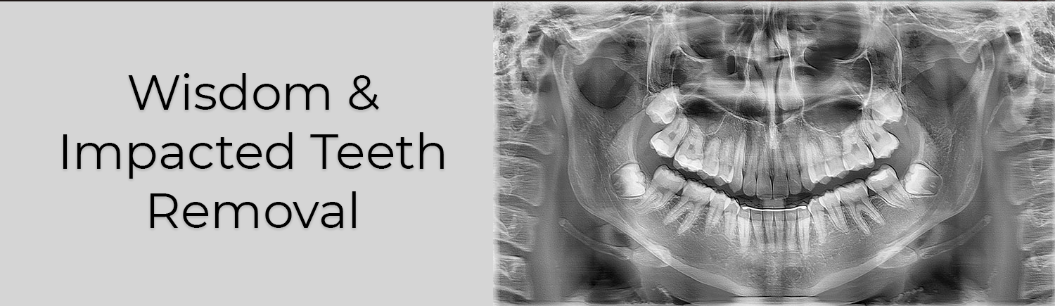 wisdom & impacted teeth removal